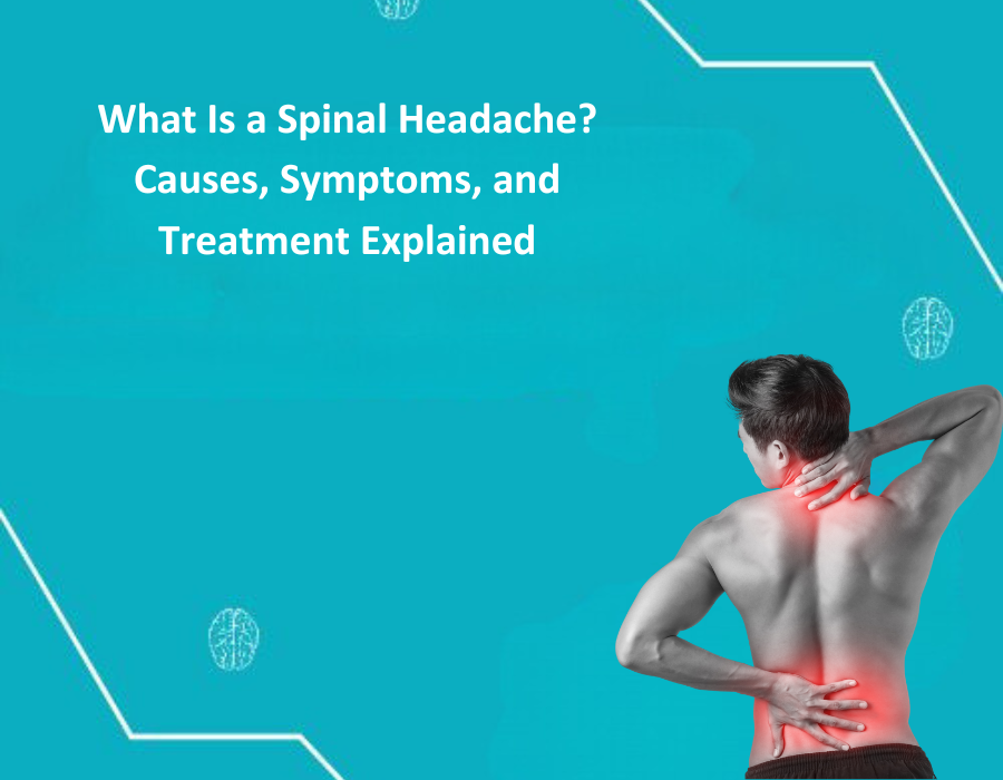 Spinal Headache